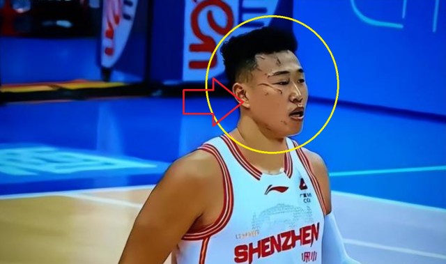 开云官网-可怜！一只手防守，一只手护自己的脸 球迷：CBA太可怕了